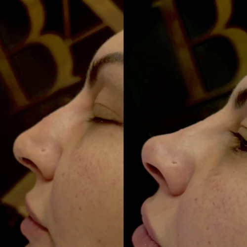 348751B6-1D9C-420B-B6BE-54EED8365CA7